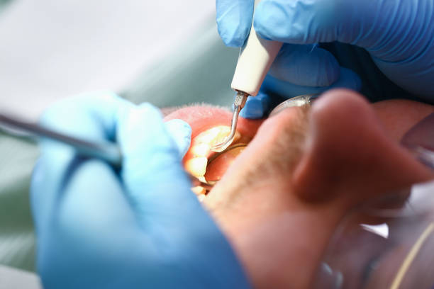 Best Emergency Treatment for Oral Infections in Laurens, SC